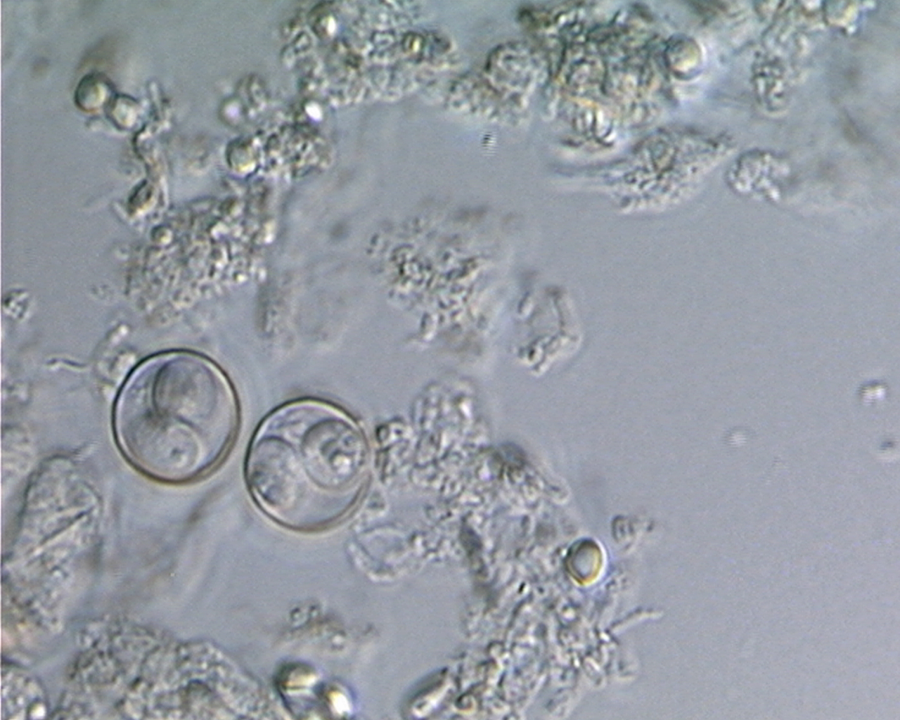 FDA, CDC Develop Robust Strategy to Prevent Illnesses Caused by Cyclospora 1