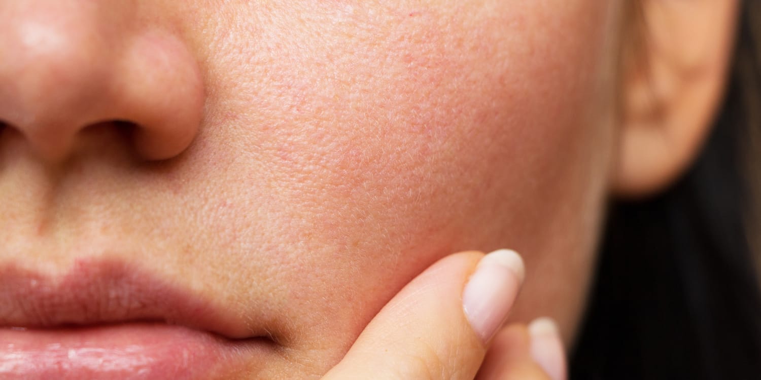 7 ingredients that make your pores and skin look younger 6